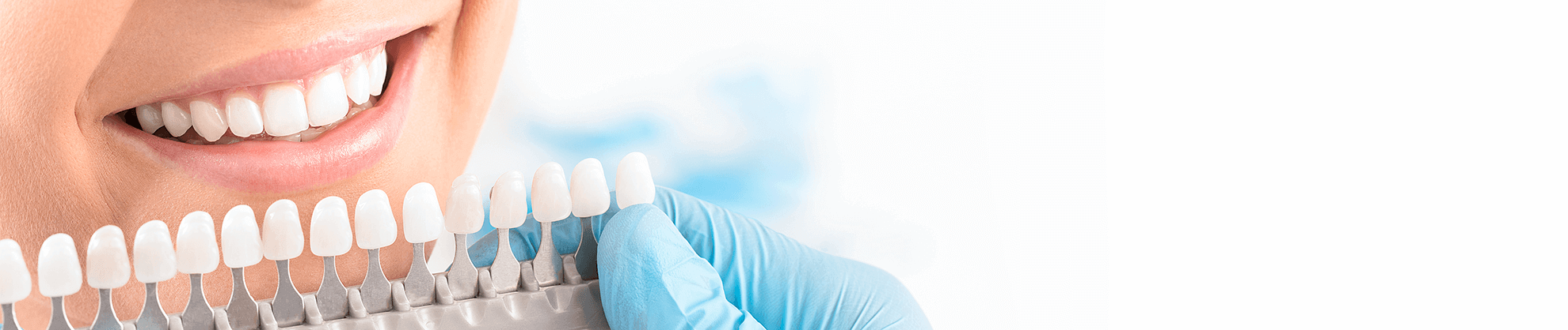 Dental Veneers in Boca Raton, FL